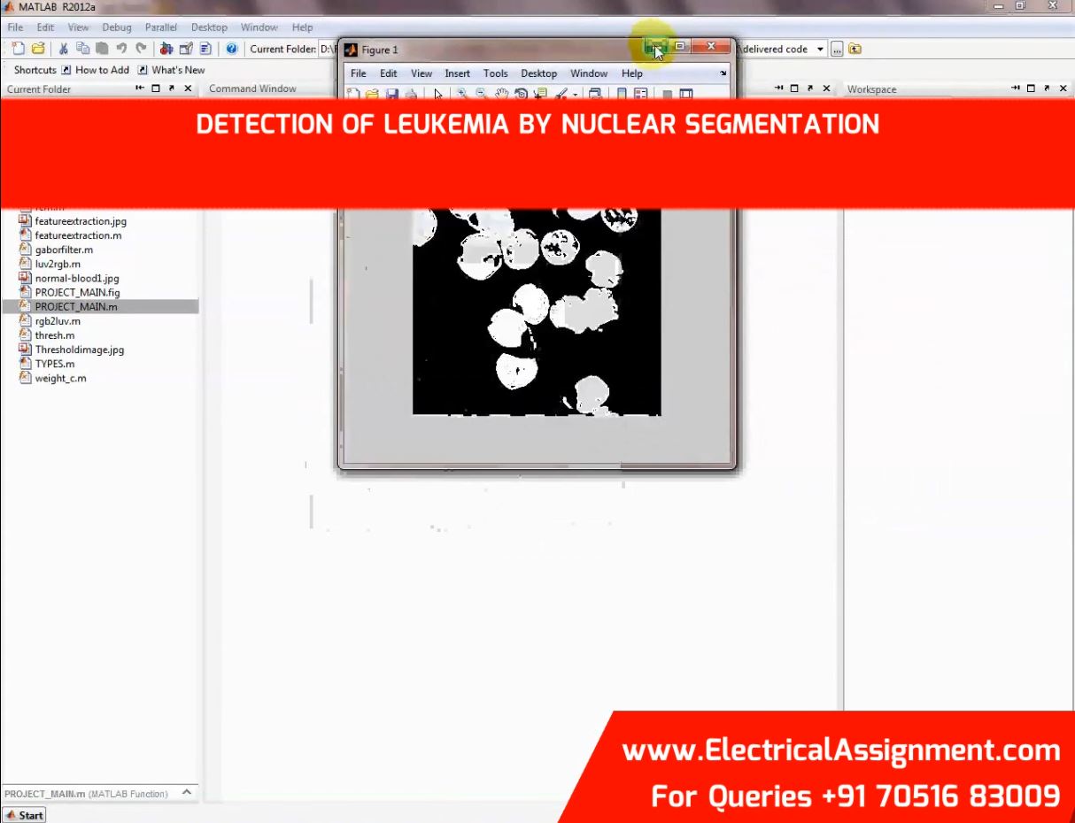 DETECTION OF LEUKEMIA BY NUCLEAR SEGMENTATION simulation output result 1 DETECTION OF LEUKEMIA BY NUCLEAR SEGMENTATION simulation output result 1