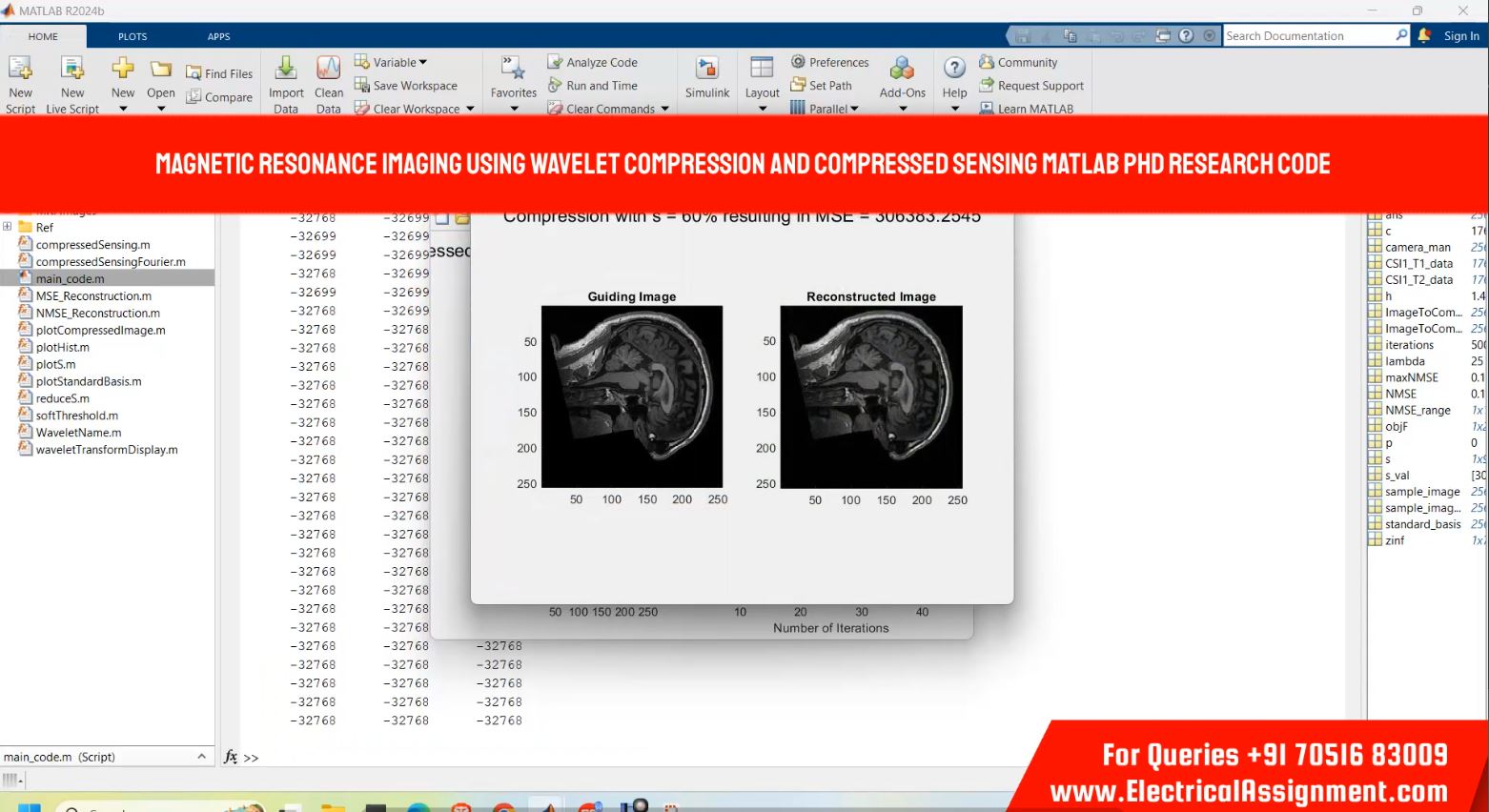 Magnetic resonance imaging using wavelet compression and compressed sensing MATLAB PHD RESEARCH CODE simulation output result 1 Magnetic resonance imaging using wavelet compression and compressed sensing MATLAB PHD RESEARCH CODE simulation output result 1