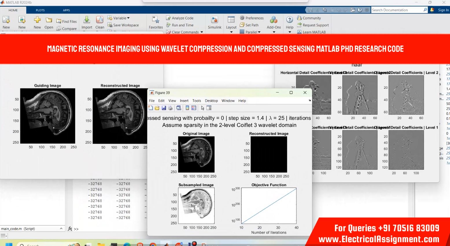 Magnetic resonance imaging using wavelet compression and compressed sensing MATLAB PHD RESEARCH CODE simulation output result 2 Magnetic resonance imaging using wavelet compression and compressed sensing MATLAB PHD RESEARCH CODE simulation output result 2