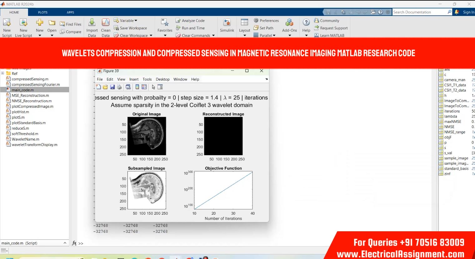 Magnetic resonance imaging using wavelet compression and compressed sensing MATLAB PHD RESEARCH CODE simulation output result 7 Magnetic resonance imaging using wavelet compression and compressed sensing MATLAB PHD RESEARCH CODE simulation output result 7