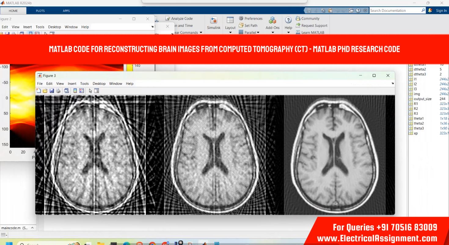 Matlab code for reconstructing brain images from computed tomography (CT) - MATLAB PHD RESEARCH CODE simulation output result 2 Matlab code for reconstructing brain images from computed tomography (CT) - MATLAB PHD RESEARCH CODE simulation output result 2
