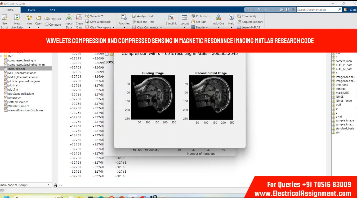 Wavelets compression and compressed sensing in magnetic resonance imaging MATLAB RESEARCH CODE simulation output result 1 Wavelets compression and compressed sensing in magnetic resonance imaging MATLAB RESEARCH CODE simulation output result 1