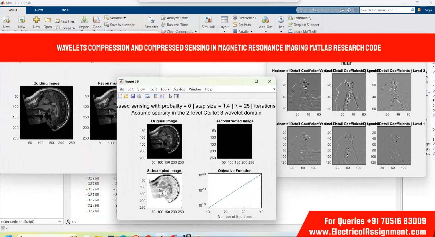 Wavelets compression and compressed sensing in magnetic resonance imaging MATLAB RESEARCH CODE simulation output result 2 Wavelets compression and compressed sensing in magnetic resonance imaging MATLAB RESEARCH CODE simulation output result 2