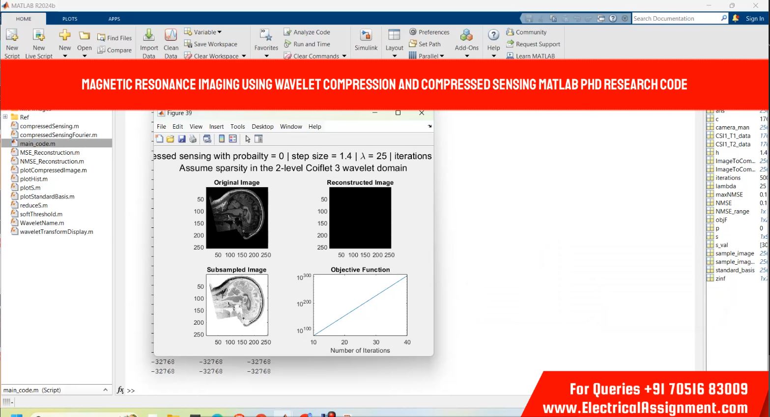 Wavelets compression and compressed sensing in magnetic resonance imaging MATLAB RESEARCH CODE simulation output result 7 Wavelets compression and compressed sensing in magnetic resonance imaging MATLAB RESEARCH CODE simulation output result 7