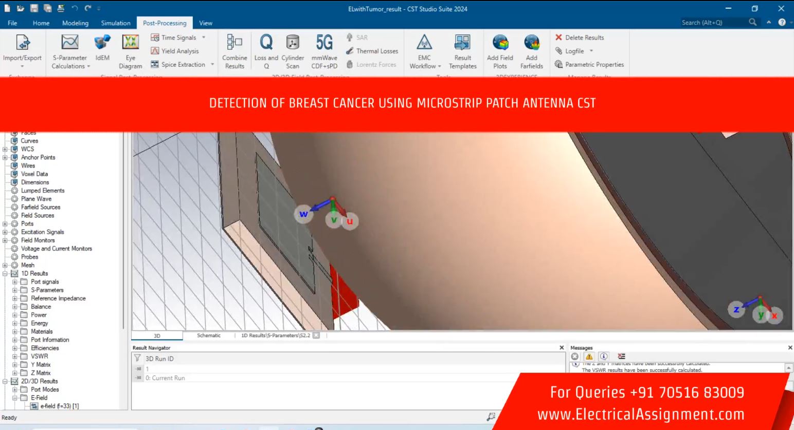 Detection Of Breast Cancer Using Microstrip Patch Antenna CST simulation project image