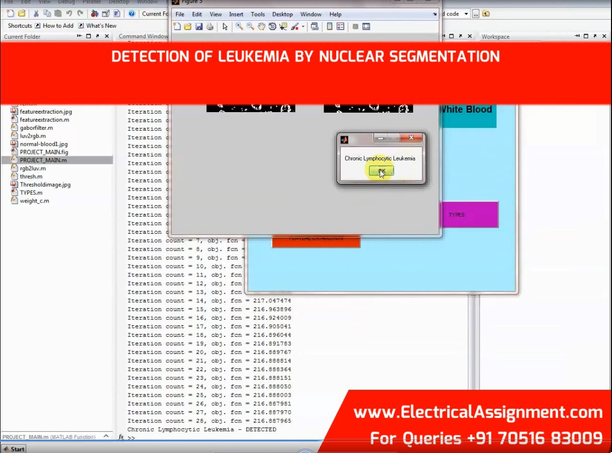 Detection Of Leukemia By Nuclear Segmentation simulation project image