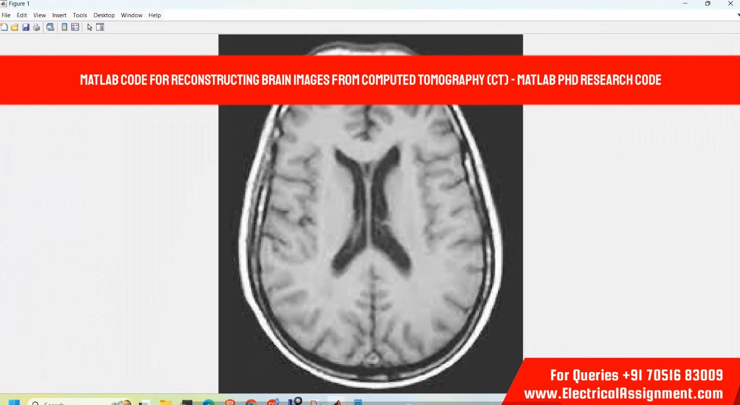 MATLAB code for reconstructing brain images from computed tomography (CT) - MATLAB PHD RESEARCH CODE simulation project image