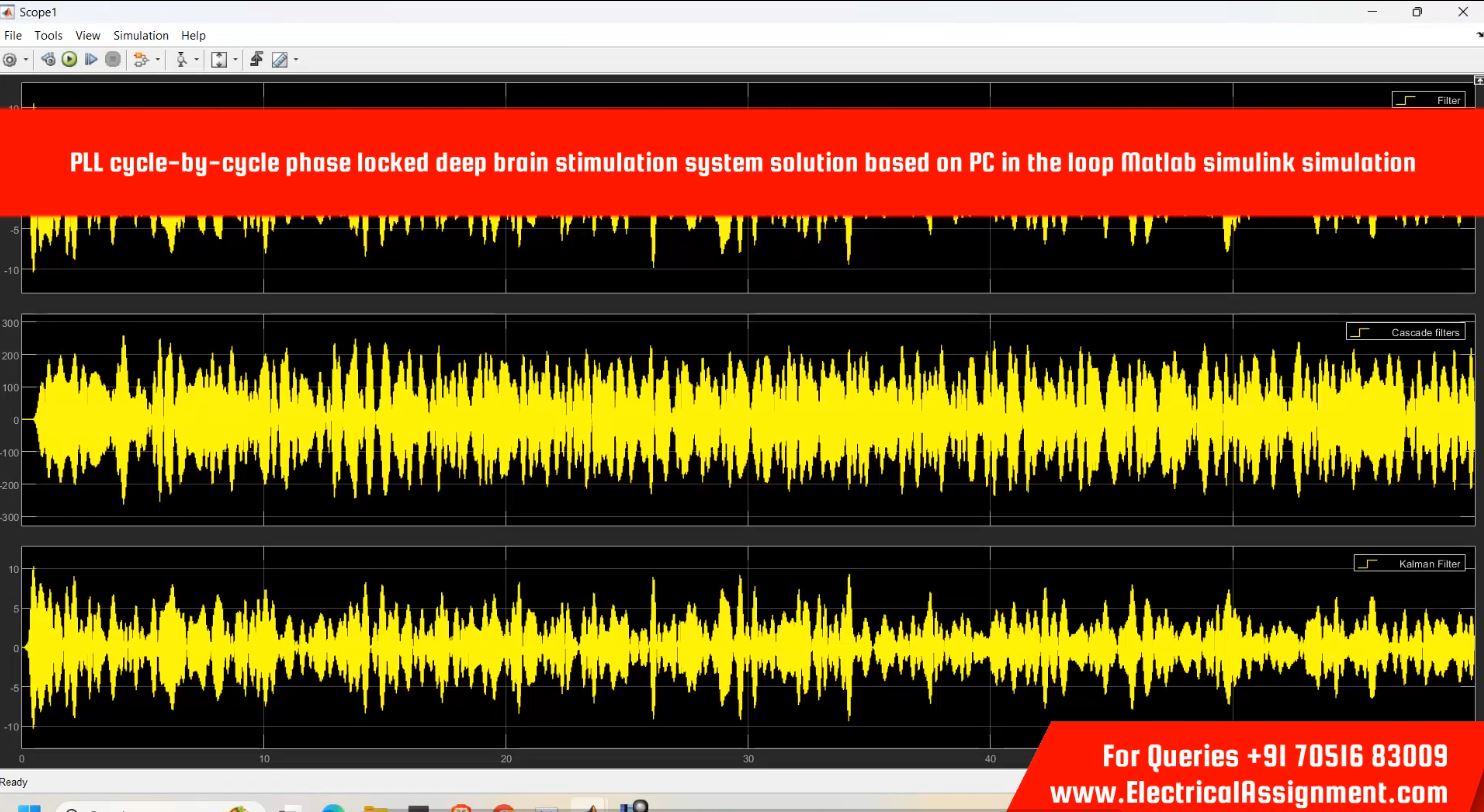 PLL cycle-by-cycle phase locked deep brain stimulation system solution based on PC in the loop MATLAB simulink simulation simulation project image